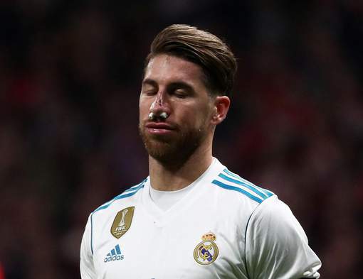 Le nez explosé de Sergio Ramos